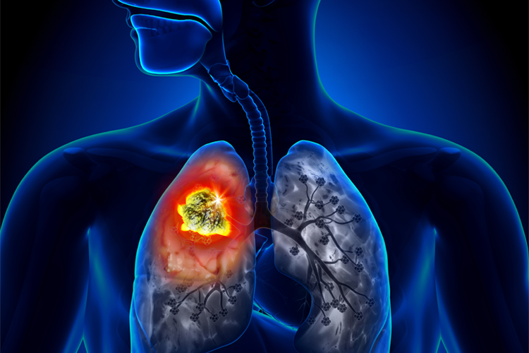 222282b705e75459a1223638152bac